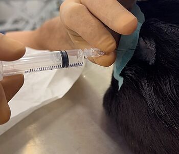 💉Epidurale Infiltration
 
Bei Patienten mit degenerativer lumbosakraler Stenose ist die epidurale Infiltration eine der...